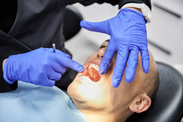 Best Emergency Root Canal Treatment in Venice Gardens, FL